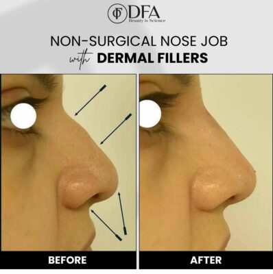 Screenshot_2024-10-18-14-07-48-363_com.instagram.android-edit